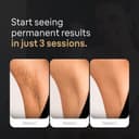 Braun IPL 5152 Silk Expert Pro view 2