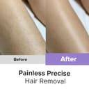 WOMENHOOD 5-in-1 Epilator Kit view 3