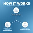 Sotrue 1.0mm Derma Roller view 3