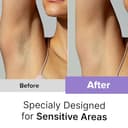 WOMENHOOD 5-in-1 Epilator Kit view 2
