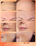 NEWKEY 7-Color LED Face Mask view 3