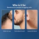 Man Matters 1.00mm Derma Roller view 5