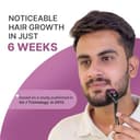 Sotrue 0.5mm Derma Roller view 2