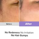 WOMENHOOD 5-in-1 Epilator Kit view 5