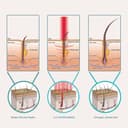 DHI Laser Cap 108 Diodes view 2