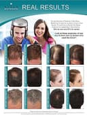 iGrow Hair Rejuvenation System view 8