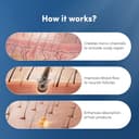 Man Matters 1.00mm Derma Roller view 8