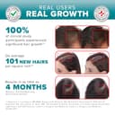 iGrow Hair Rejuvenation System view 6