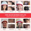 iRestore Professional 282 LLLT Helmet view 6