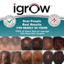 iGrow Hair Rejuvenation System view 2