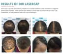 DHI Laser Cap with 272 Laser Diodes view 5